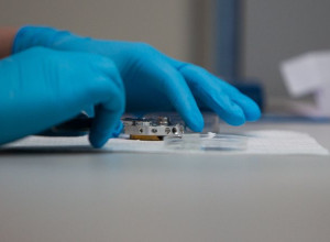 Анна Попова: вирус оспы обезьян вышел на рекордные показатели контактов с человеком